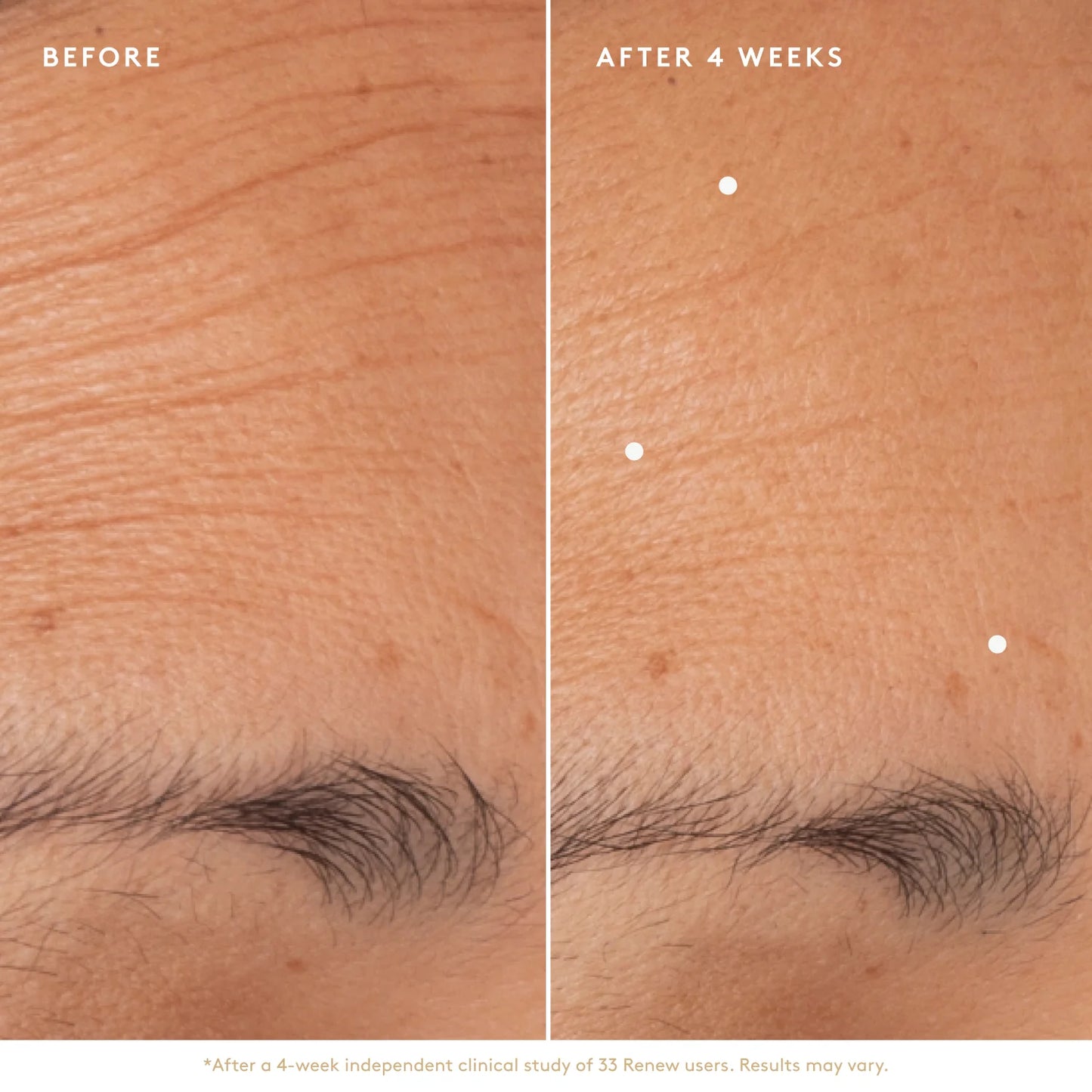 Renew Resurfacing Night Serum