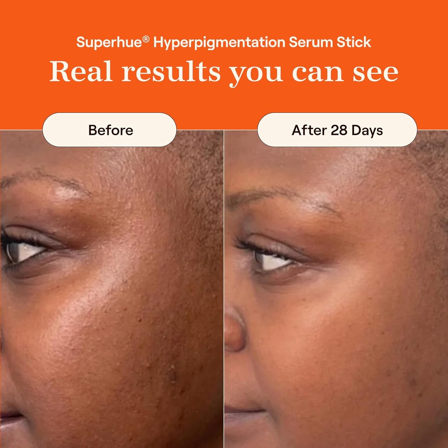Superhue Hyperpigmentation Serum Stick - Balm-To-Serum Stick for Face & Body & Hueguard: 3-In-1 Mineral Sunscreen, Moisturizer, & Primer for Face and Body - Travel Sized - SPF 30
